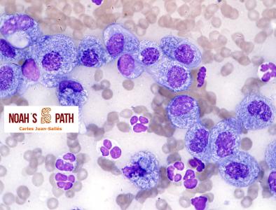Conjuntivitis piogranulomatosa por micobacteriosis