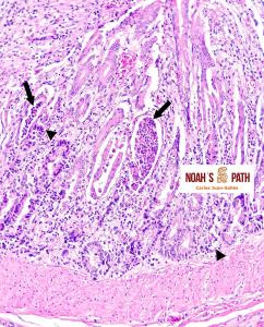 Enteritis con necrosis de criptas, coronavirus