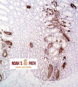 Marcaje de antígeno de coronavirus entérico en enteritis - Inmunohistoquímica de coronavirus