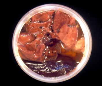 Remisión de abundante tejido con secciones demasiado gruesas o paquetes viscerales completos en escaso formol