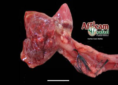 Neumonía por Pseudomonas aeruginosa 