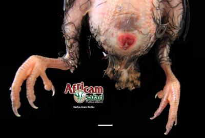 Onfalitis por Pseudomonas aeruginosa 