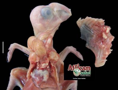 Pericarditis por Pseudomonas aeruginosa 