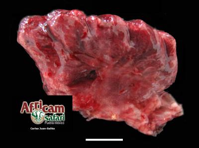 Neumonía por Pseudomonas aeruginosa 
