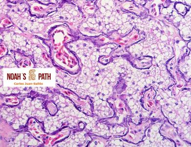 Mineralización sinusoidal hepática y lipidosis