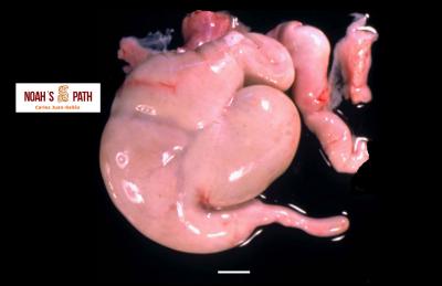 Estómago normal de múltiples cámaras