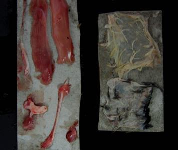 Fijación de nervios, piel, y músculo extendidos, y órganos pequeños adheridos a fragmentos de cajas de agujas/jeringas