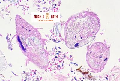 Trofozoítos del ciliado <i>Troglodytella</i>