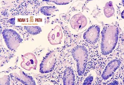 Enterobiasis, troglodytelliosis