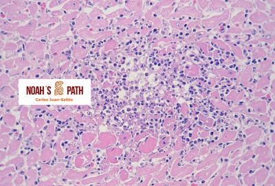 Miocarditis, toxoplasmosis localizada reactivada por estrés/agresión por congénere y gestación