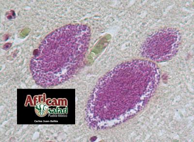 Encefalitozoonosis (E. cunniculi), encéfalo - tinción de Brown-Brenn