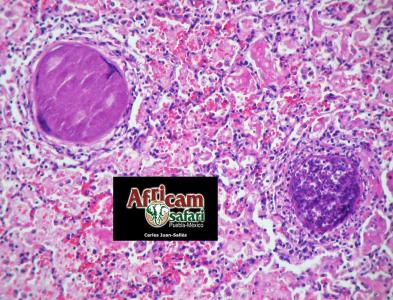 Neumonía intersticial, besnoitiasis