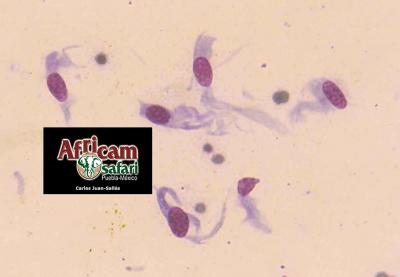 Sarcoide inguinal asociado a BPV-1, citología