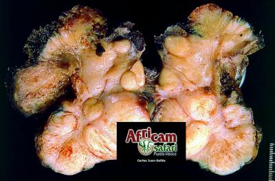 Sarcoide inguinal asociado a BPV-1