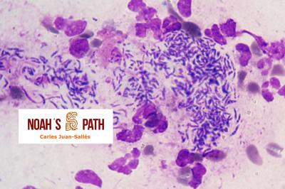 Piotórax (citología), Pseudomonas luteola