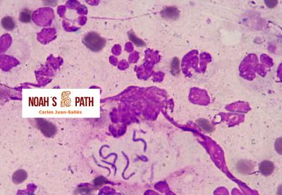 Piotórax (citología), Pseudomonas luteola