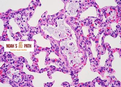 Klebsiellosis septicémica - control de infecciones en animales en cuarentena 
