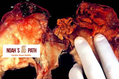 Metritis salmonelosis - control de infecciones zoonóticas en animales de zoo infantil y presa