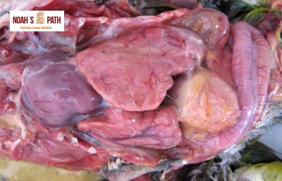 Cirrosis lipídica - monitoreo y prevención de enfermedades nutricionales