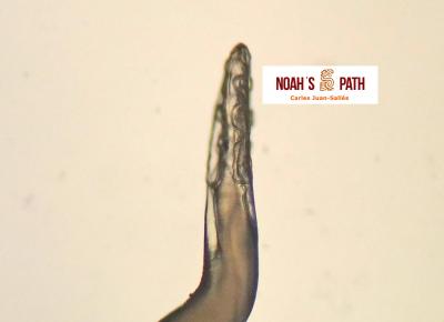 Cordones cuticulares diagnósticos de espirúrido acuárido en pólipos proventriculares de un lori