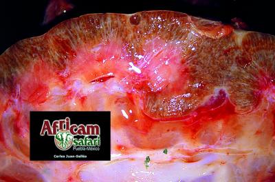 Nefritis crónica - leptospirosis 