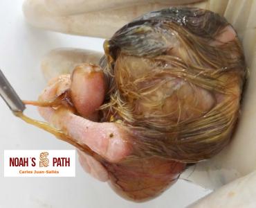 Embrión E46 no eclosionado con malformación de saco vitelino y estrangulamiento de pata derecha