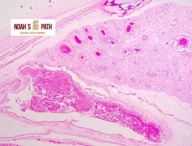 Neumonía y aerosaculitis bacterianas embrionarias