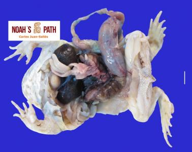 Nefritis, microsporidiosis 