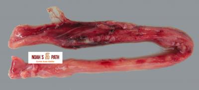 Esofagitis supurativa con hemorragia - Miofascitis del hurón