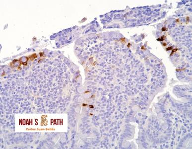 Marcaje de antígeno de coronavirus entérico en enteritis - Inmunohistoquímica de coronavirus