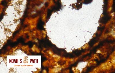 Leptospirosis - tinción de Warthin-Starry