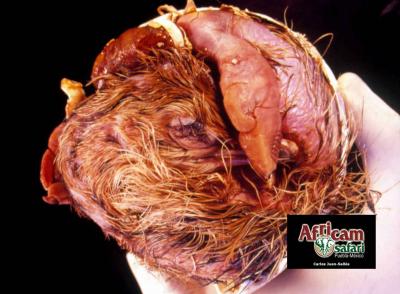 Malposición (EPD sobre cabeza) y anasarca, embrión E46 no eclosionado