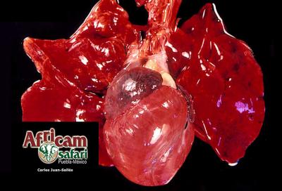 Hipertrofia concéntrica ventricular derecha, hipoxia de la altitud