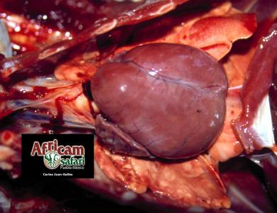 Hipertrofia concéntrica ventricular derecha, hipoxia de la altitud