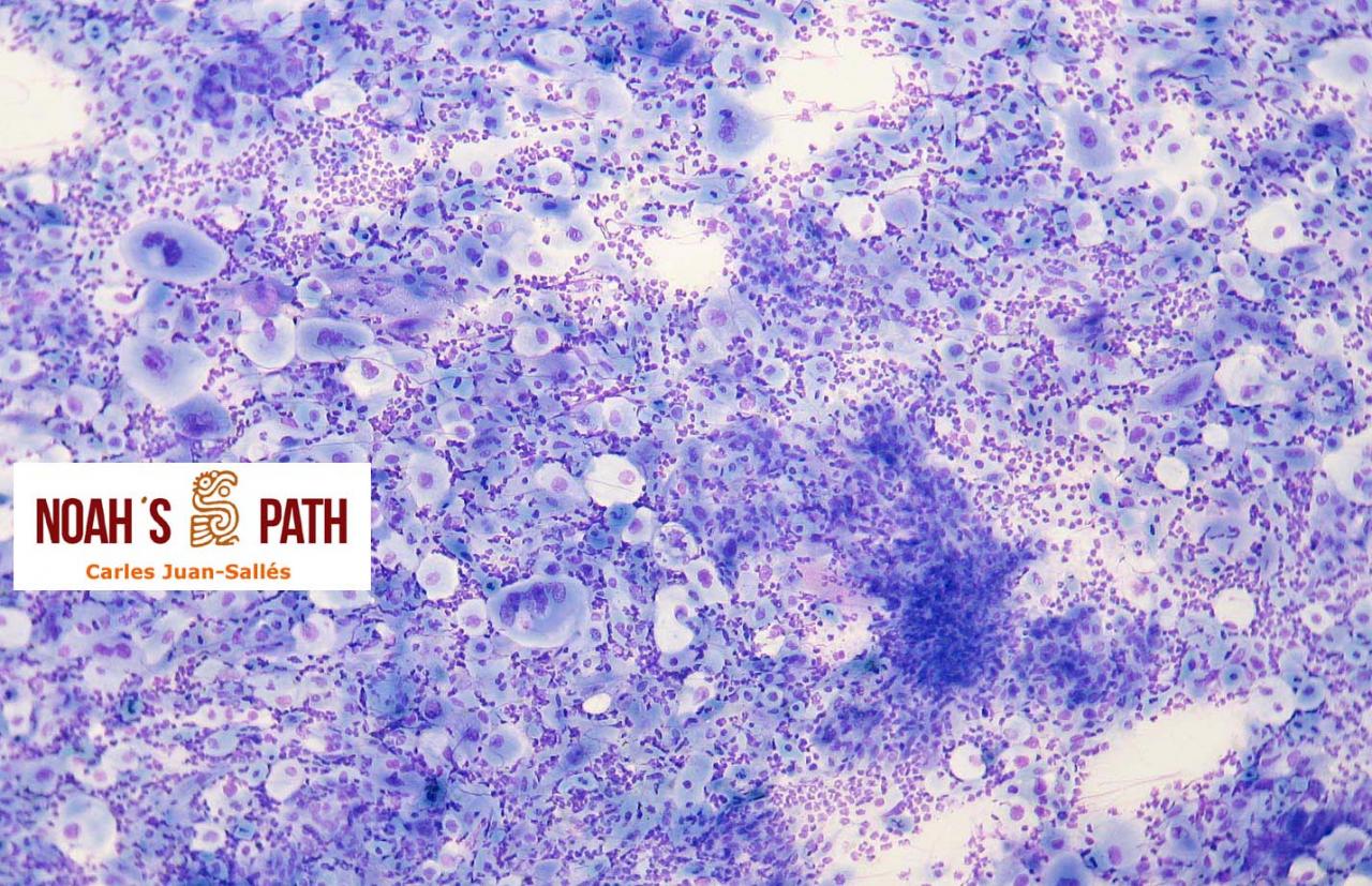 Nombre de la segunda foto