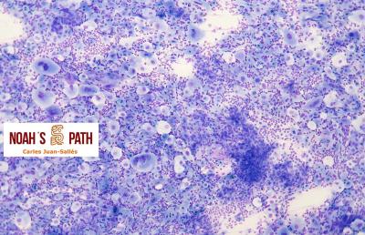 Nombre de la segunda foto